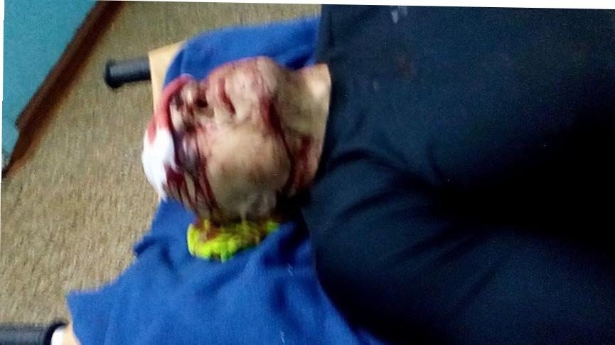 В центре Одессы жестоко избили предпринимателя: Гордиенко обещает жестоко отомстить